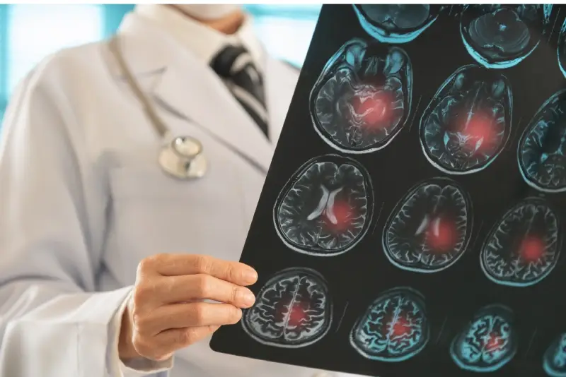 A doctor in a white coat holds up an MRI scan displaying multiple brain slices with red highlighted areas.