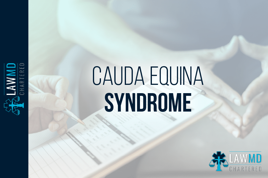 Cauda Equina Syndrome